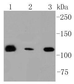 RNF20 Rabbit mAb