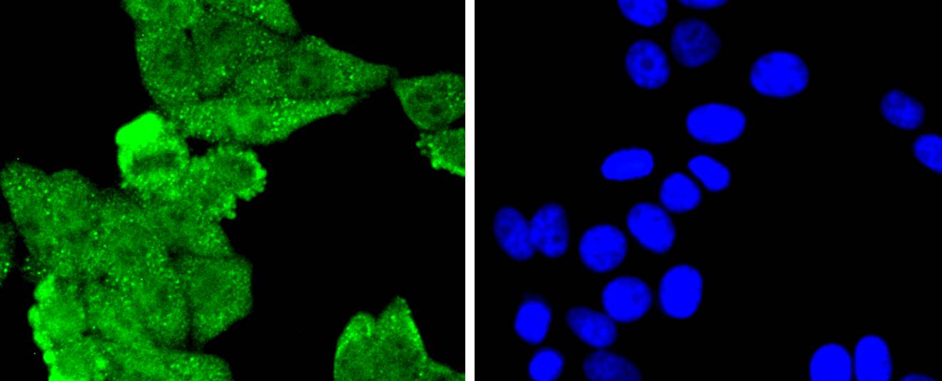 MLH1 Rabbit mAb