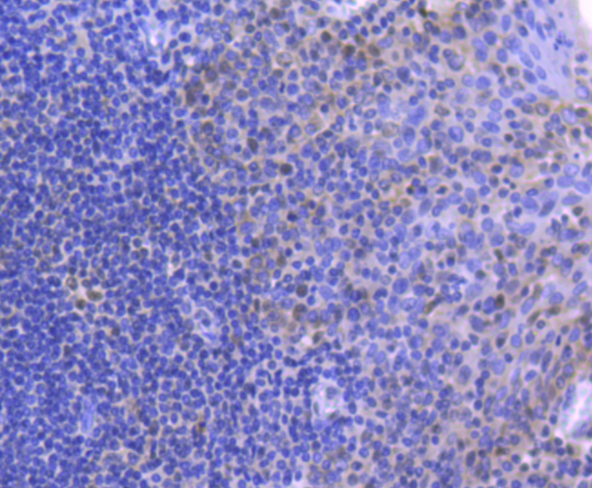 MLH1 Rabbit mAb