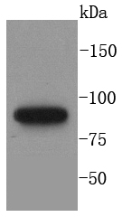 MLH1 Rabbit mAb