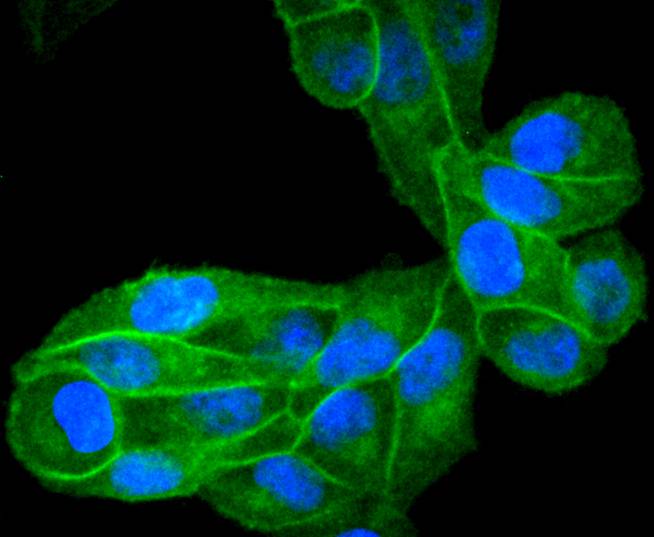 EGFR Rabbit mAb