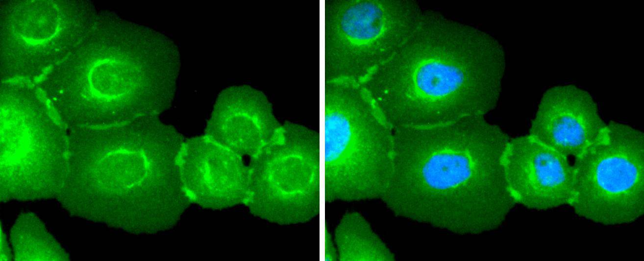 EGFR Rabbit mAb