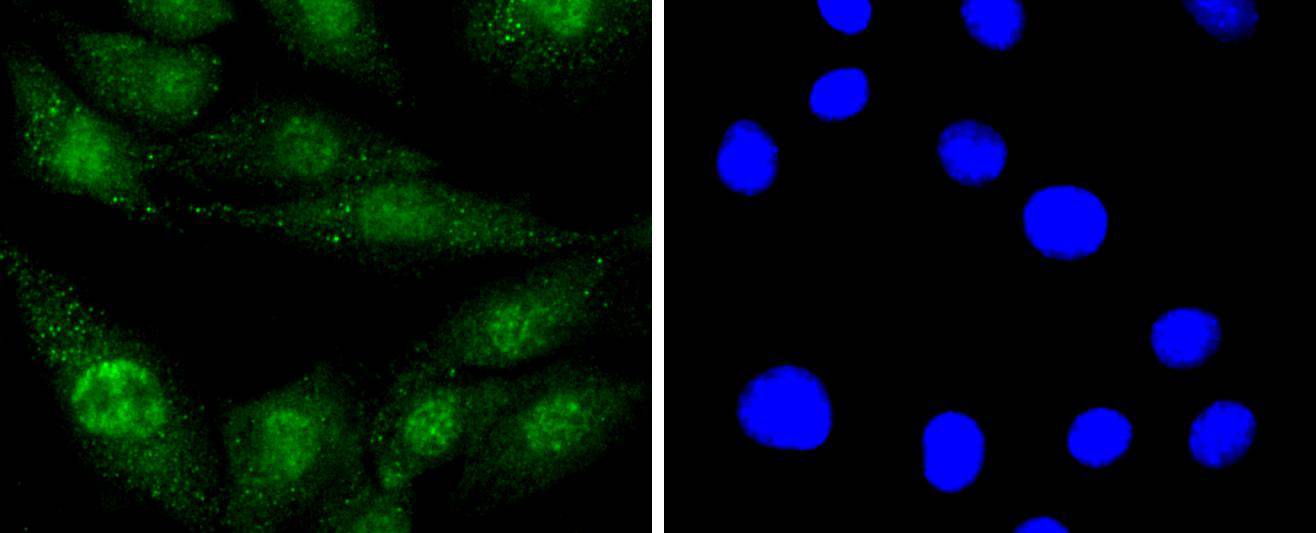 EGFR Rabbit mAb