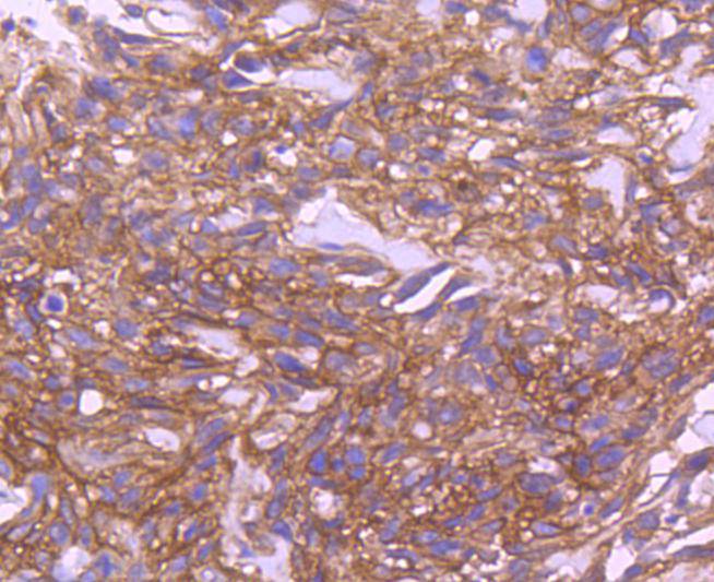 EGFR Rabbit mAb