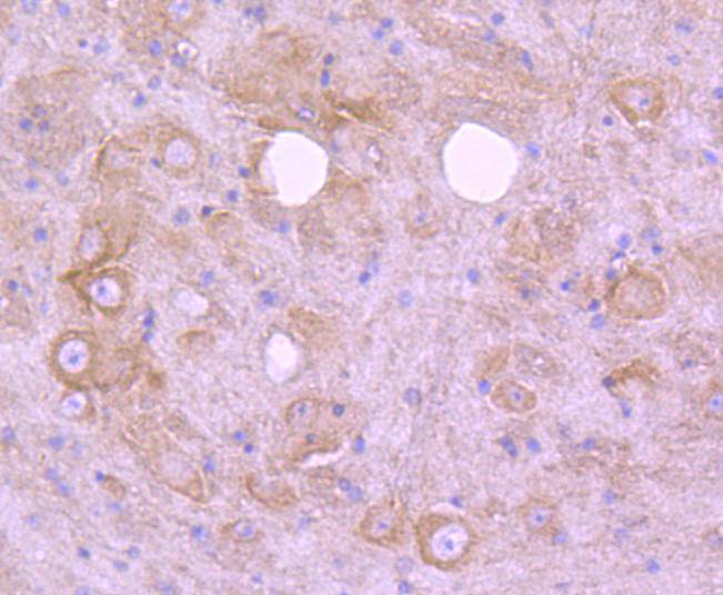 EGFR Rabbit mAb