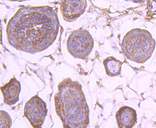 EGFR Rabbit mAb