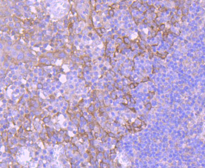 EGFR Rabbit mAb