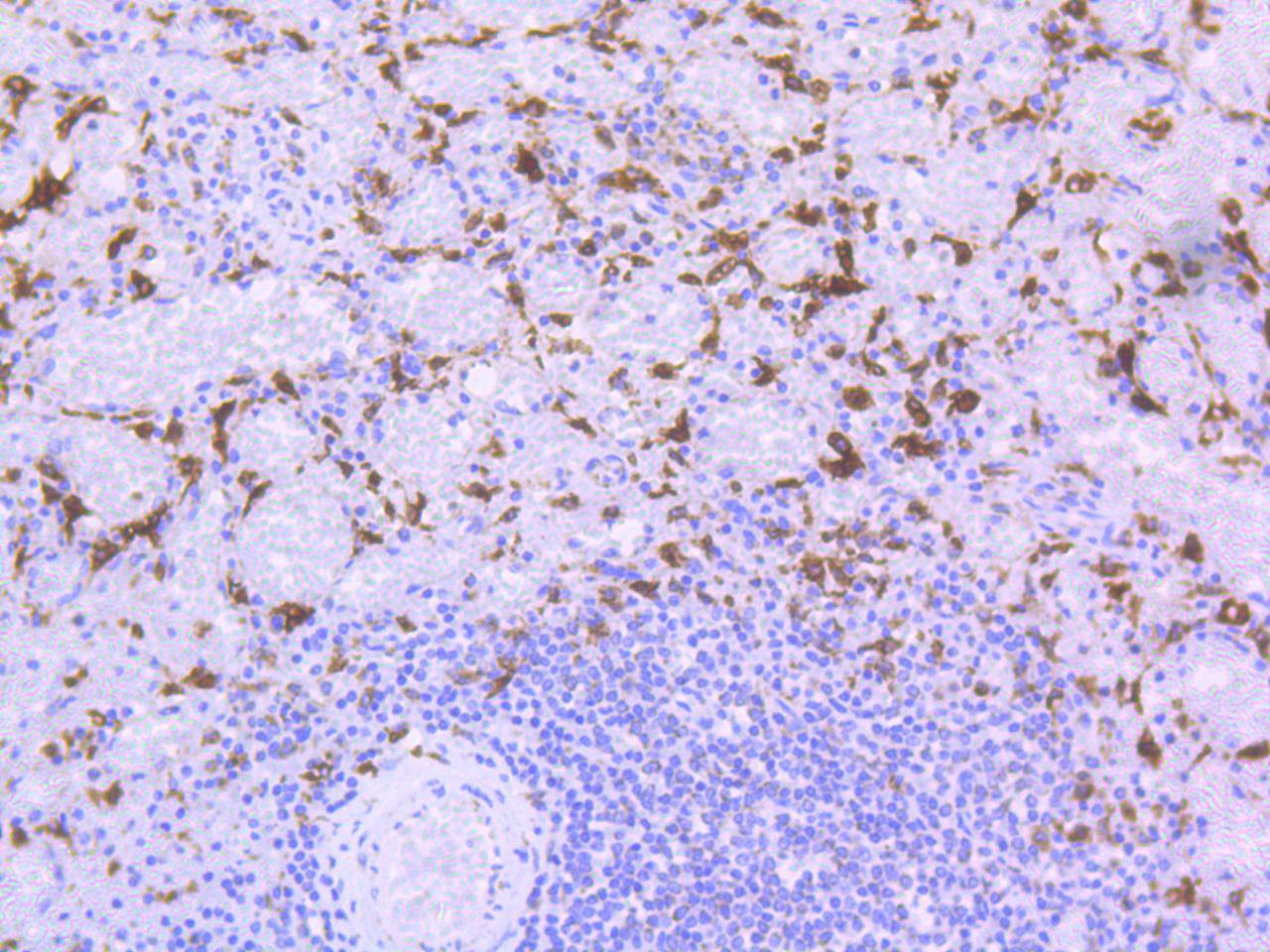 Heme Oxygenase 1(HO-1) Rabbit mAb