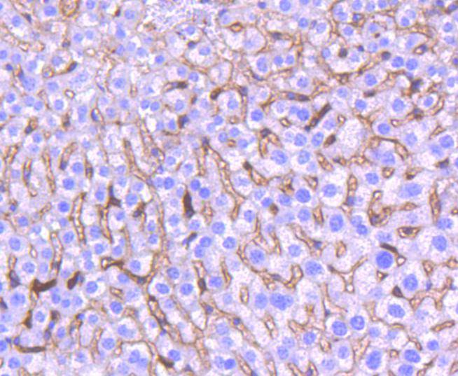 Heme Oxygenase 1(HO-1) Rabbit mAb