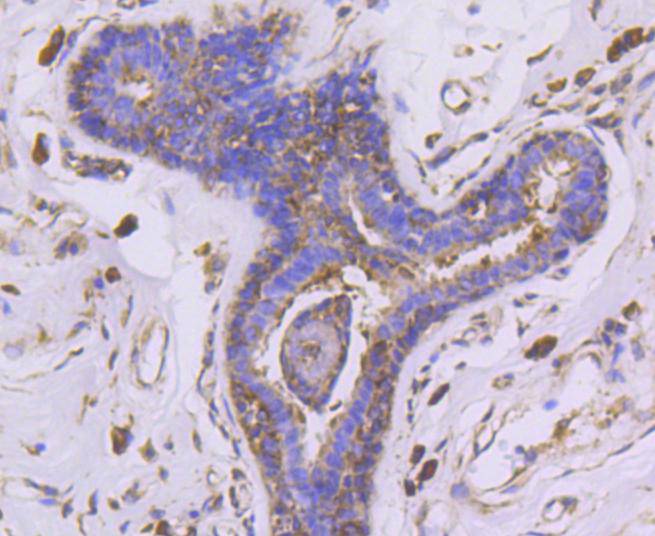 PHD1/prolyl hydroxylase Rabbit mAb