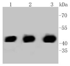 PHD1/prolyl hydroxylase Rabbit mAb