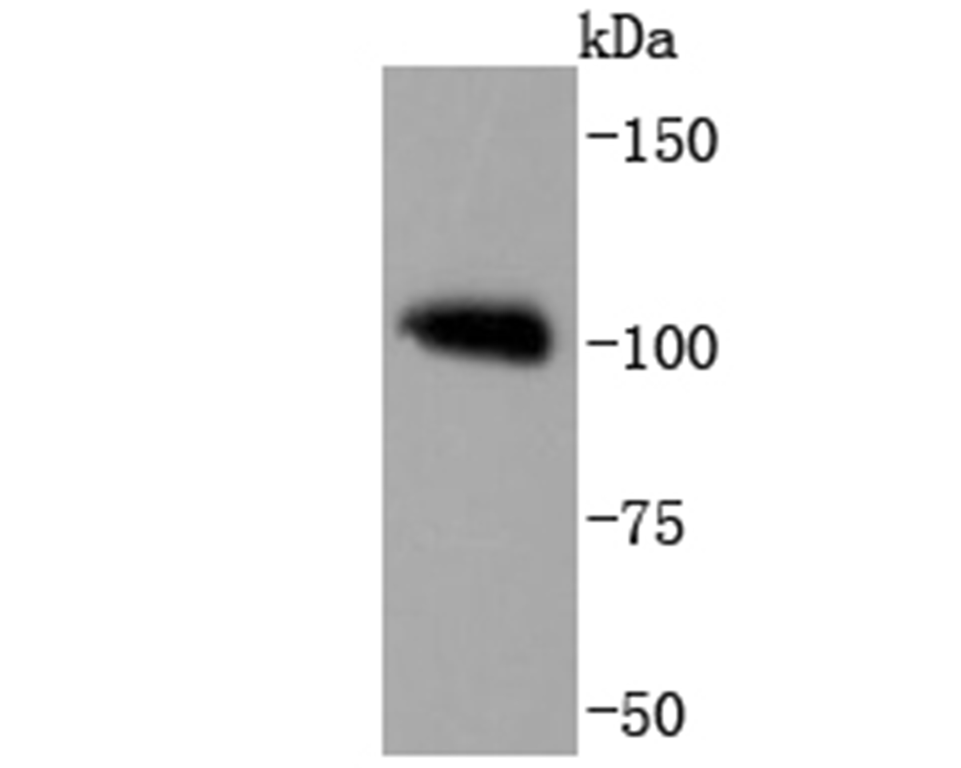 PMS2 Rabbit mAb