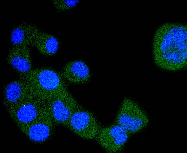 VEGF Receptor 1 Rabbit mAb