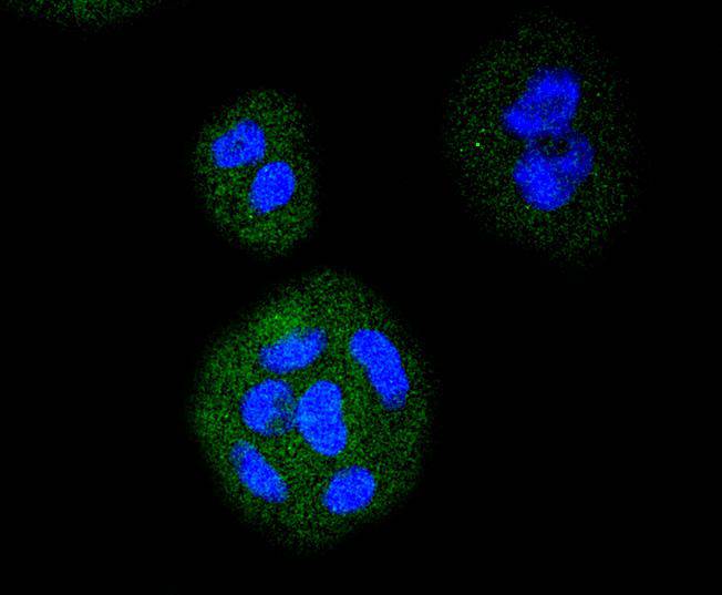 VEGF Receptor 1 Rabbit mAb