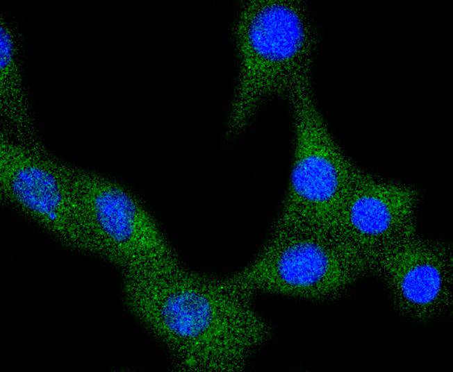 VEGF Receptor 1 Rabbit mAb