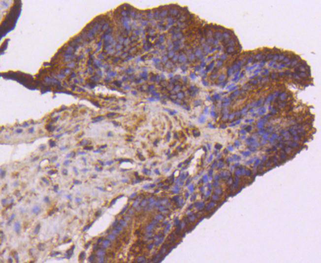 VEGF Receptor 1 Rabbit mAb