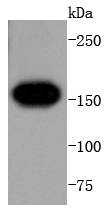 VEGF Receptor 1 Rabbit mAb