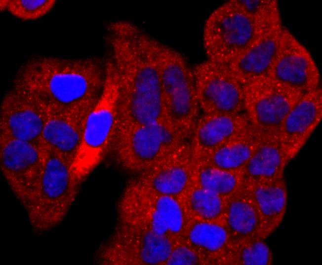 p53 Rabbit mAb