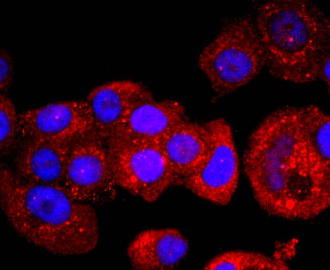 p53 Rabbit mAb