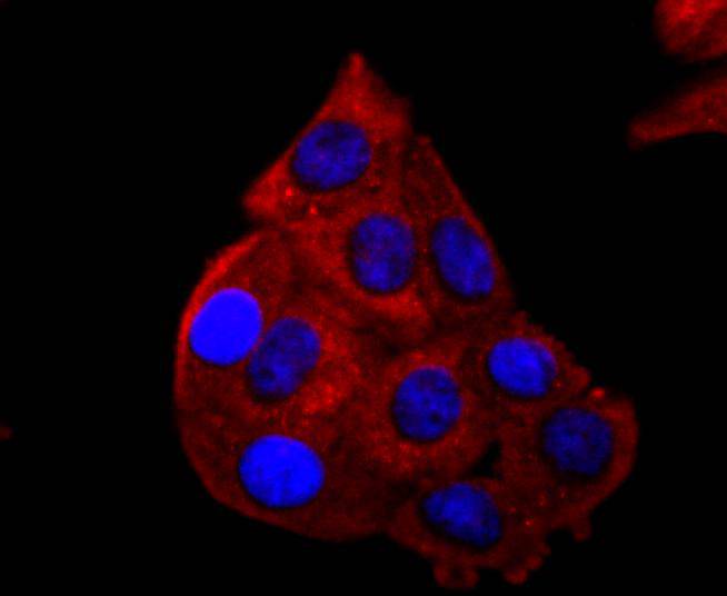 p53 Rabbit mAb