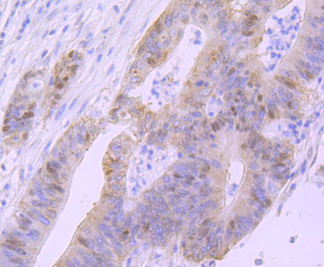 p53 Rabbit mAb