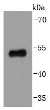 p53 Rabbit mAb