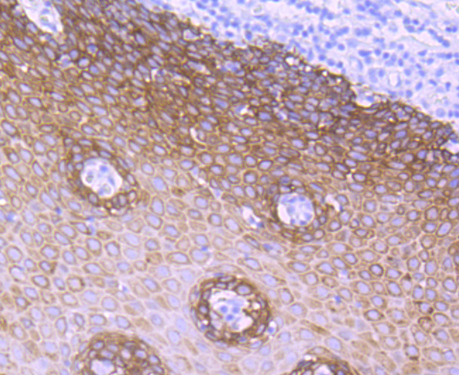 Cytokeratin 5 Rabbit mAb