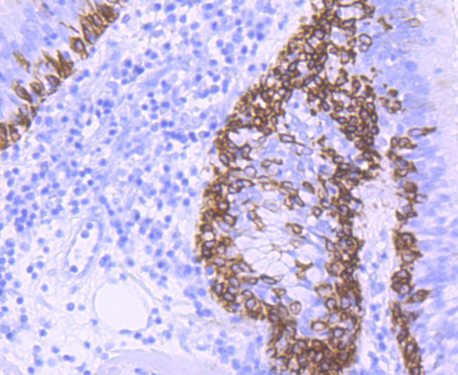 Cytokeratin 5 Rabbit mAb