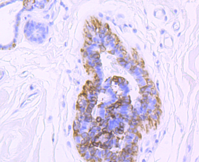 Cytokeratin 5 Rabbit mAb