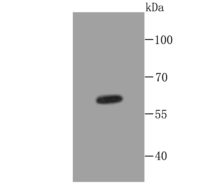 Cytokeratin 5 Rabbit mAb