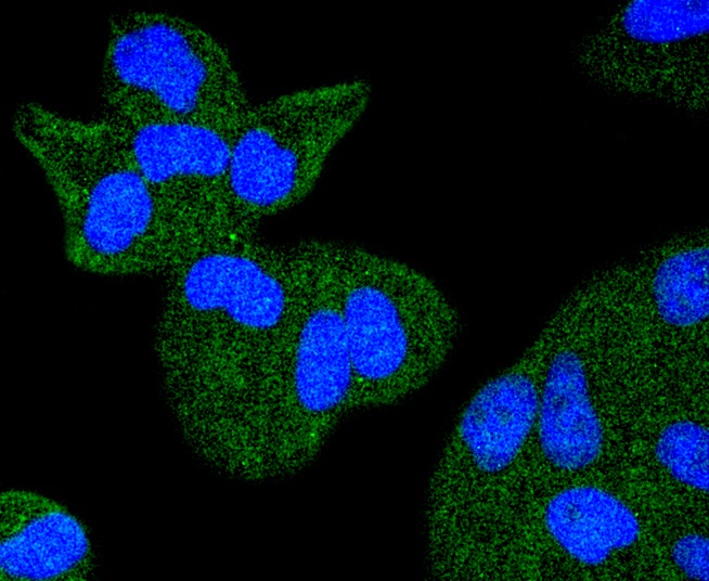 TACC3 Rabbit mAb