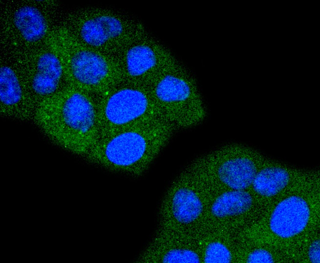 TACC3 Rabbit mAb