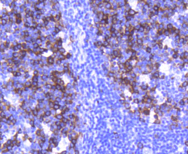 TACC3 Rabbit mAb