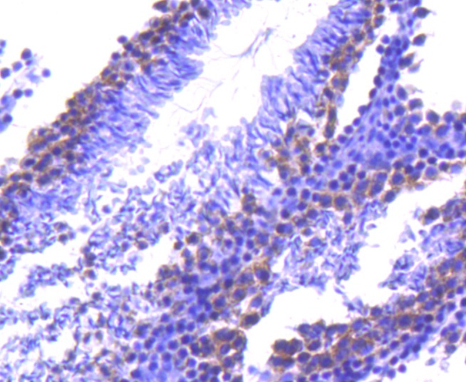 TACC3 Rabbit mAb