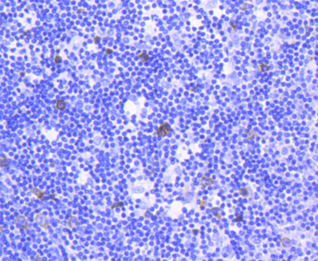 TACC3 Rabbit mAb