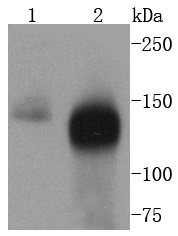 TACC3 Rabbit mAb