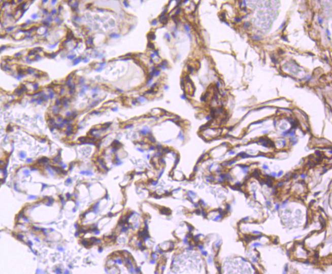 PDGF Receptor beta Rabbit mAb