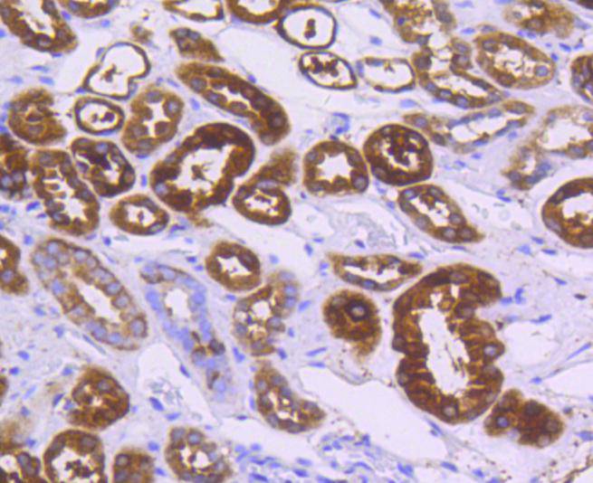 ALDH1A1 Rabbit mAb