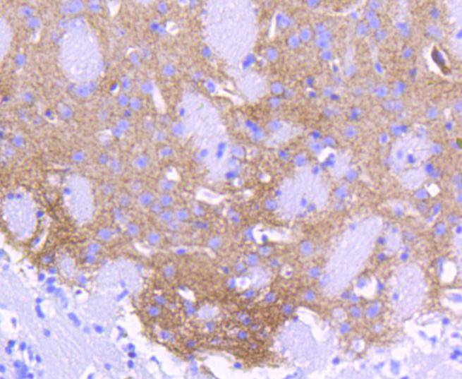 ALDH1A1 Rabbit mAb