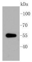 ALDH1A1 Rabbit mAb