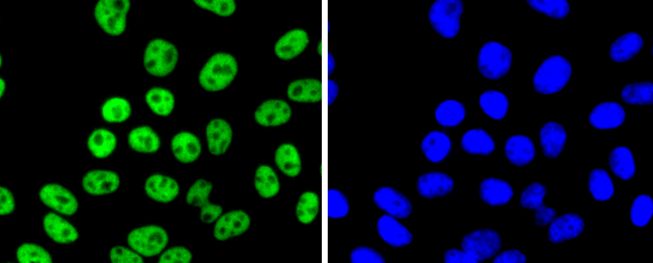 FUBP1 Rabbit mAb