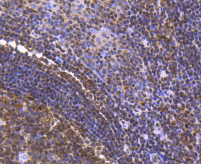 FUBP1 Rabbit mAb