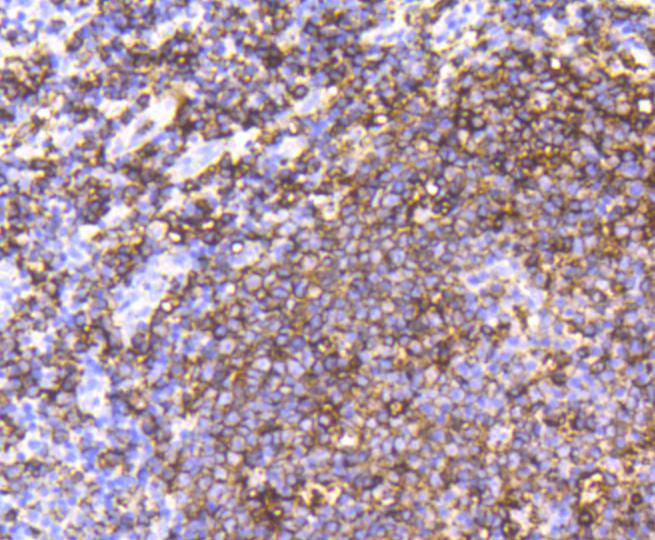 CD20 Rabbit mAb