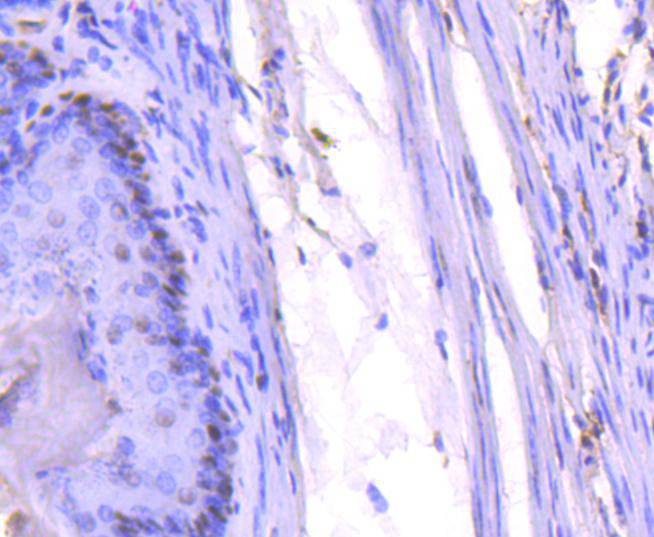 PCNA Rabbit mAb