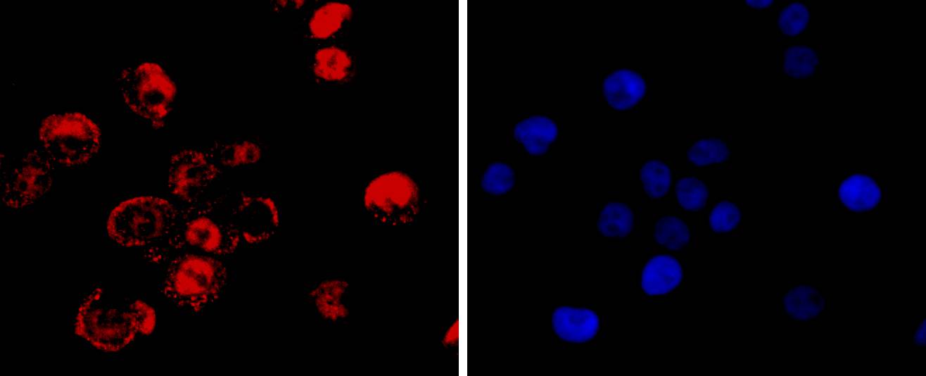 CDX2 Rabbit mAb