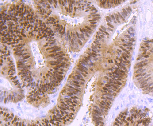 CDX2 Rabbit mAb