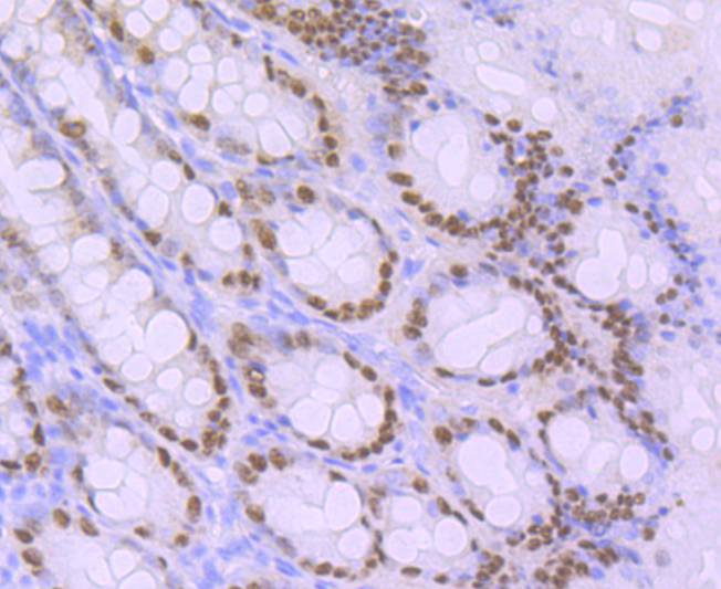 CDX2 Rabbit mAb