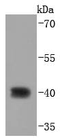 CDX2 Rabbit mAb