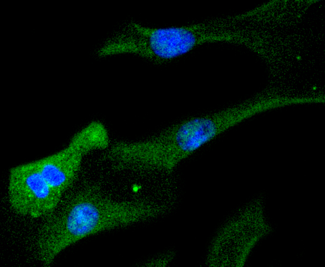 STAT6 Rabbit mAb