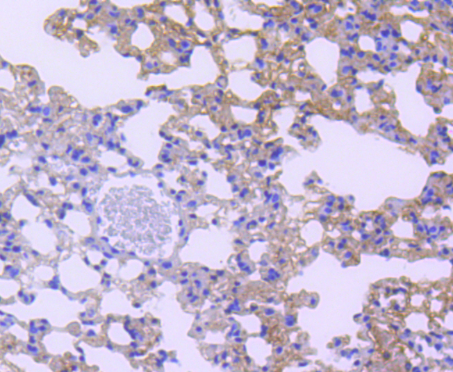 STAT6 Rabbit mAb